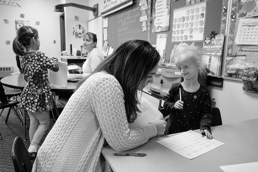Award of Excellence, Feature Picture Story - Jeremy Wadsworth / The Blade  Carly Kudzia, 7, who has progeria, takes a spelling test with parent helper Renee Darwich at Lial Elementary School in Whitehouse, Ohio.