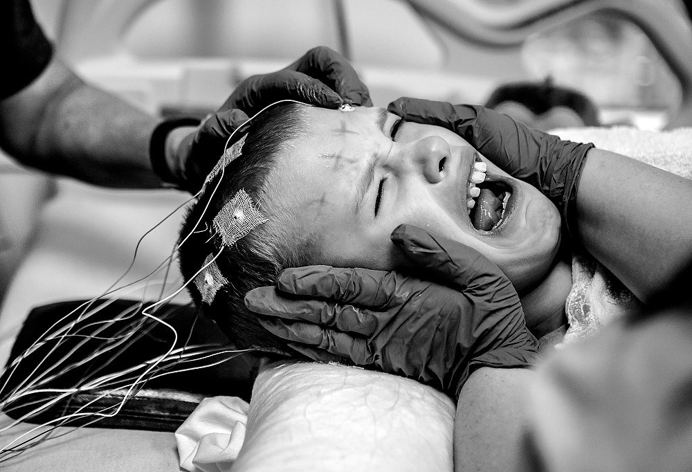 First Place, George S. Smallsreed Photographer of the Year  - Jessica Phelps / Jessica PhelpsPhoenix screams out as techs at Nationwide Children's Hospital in Columbus, Ohio, prepare the electrodes on her head for an EEG on January, 9, 2017. Phoenix recently had a couple of grand mal seizures. Phoenix is mostly non-verbal and fall on the Autism spectrum. It is common for people with Autism to have epilepsy. 